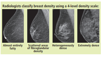 breast density x-ray