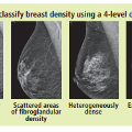 breastdensityx-ray