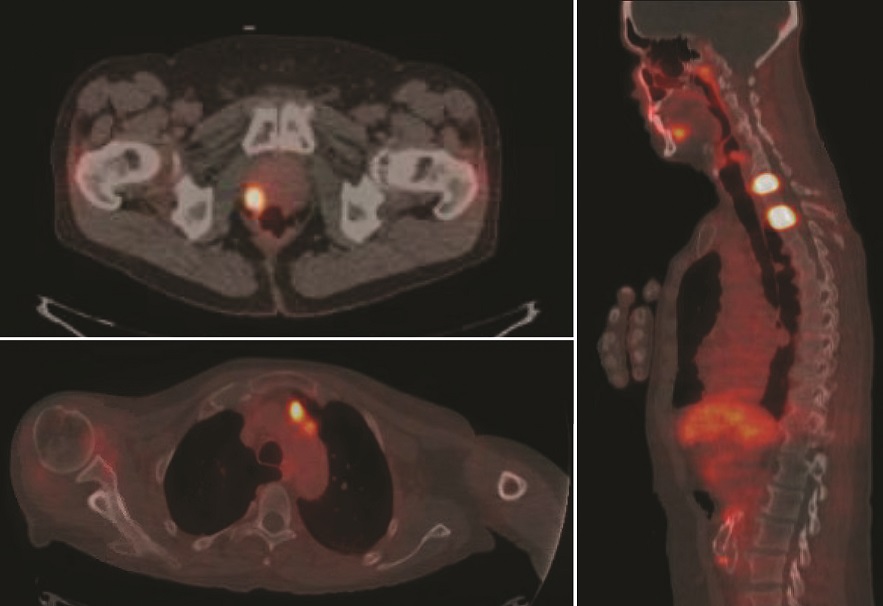 Plarify x-ray