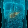 PancreaticCancer