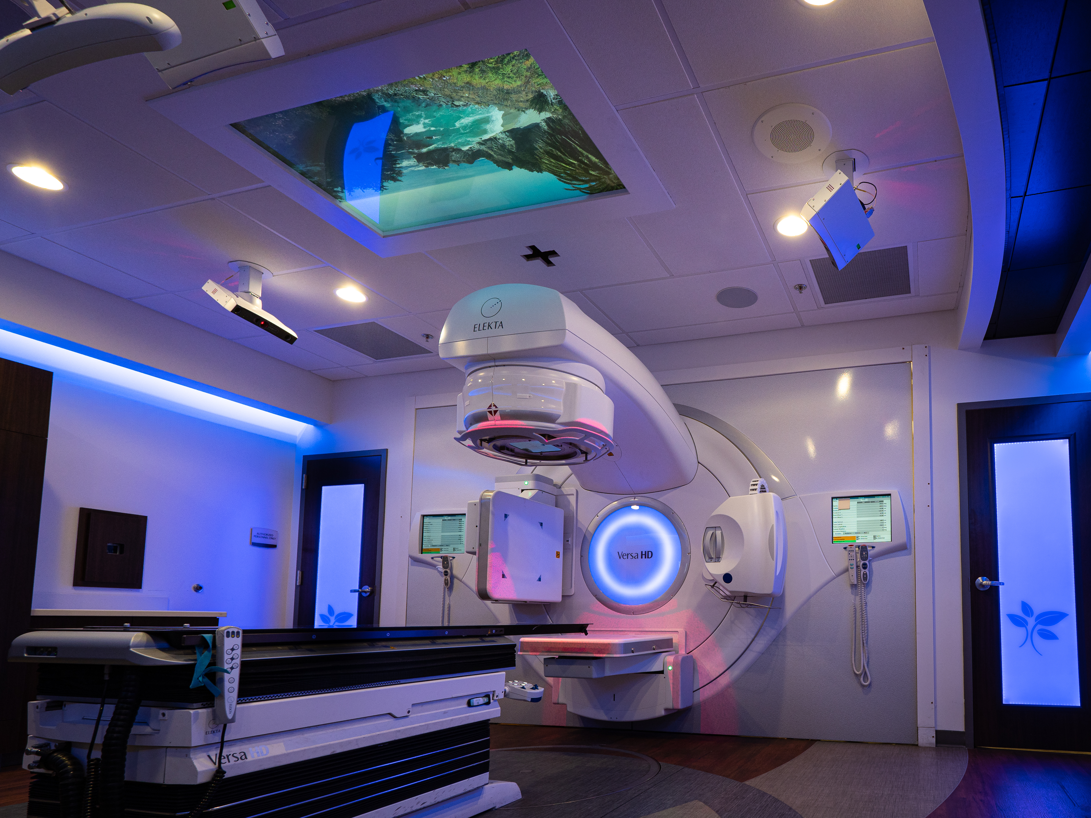 Stereotactic Body Radiation Therapy (SBRT) for Prostate Cancer