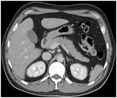 CT scans of the abdomen