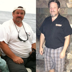 Bariatric surgery success