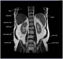 MRI of the Abdomen2